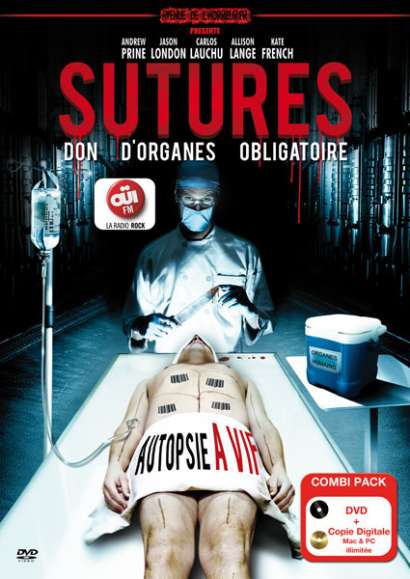 Sutures Cover Sutures